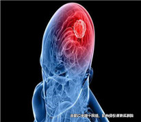 丈夫突發腦溢血，妻子撤回離婚訴訟
