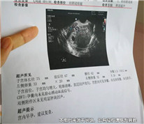 丈夫以妻子兩次擅自流產為由起訴離婚并索要賠償